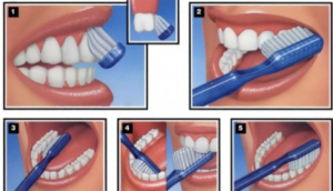Методика чистки зубов
